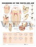 Disorders of the Teeth and Jaw Anatomical Chart